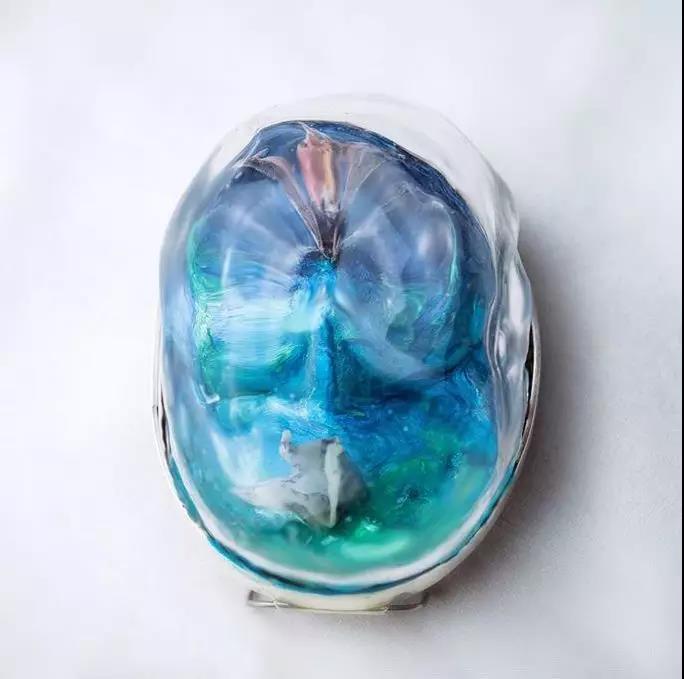 童年的相片和童話書被包裹進(jìn)泡泡般回憶